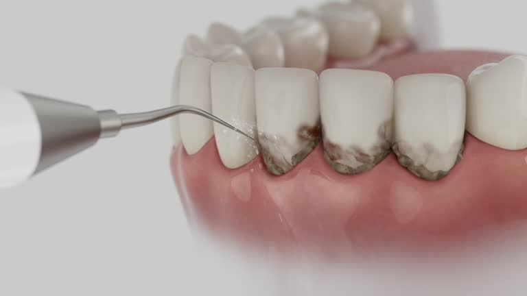 Reliable Dental contractor in Thornville, OH by Dentist Open Now